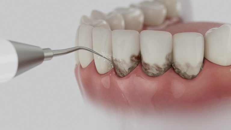 Reliable Dental Implants contractor in Dahlonega, GA by Smile Center Dentistry